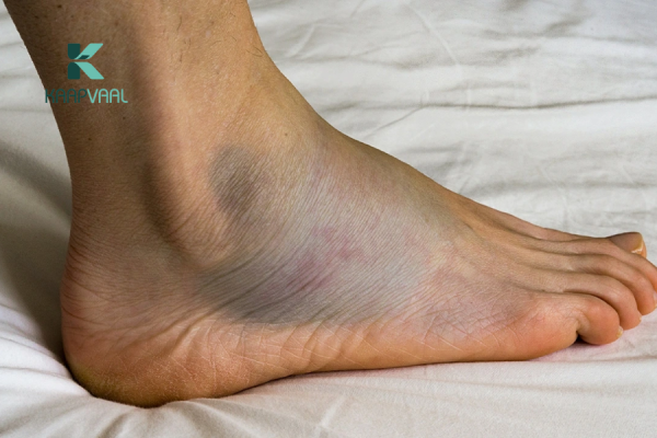 Biến chứng tiểu đường