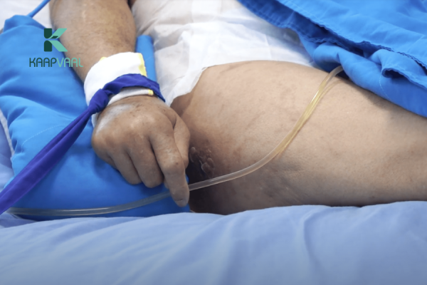 các giai đoạn loét tì đè