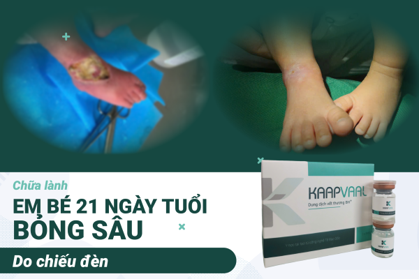 Chữa lành em bé 21 ngày tuổi bỏng sâu do chiếu đèn