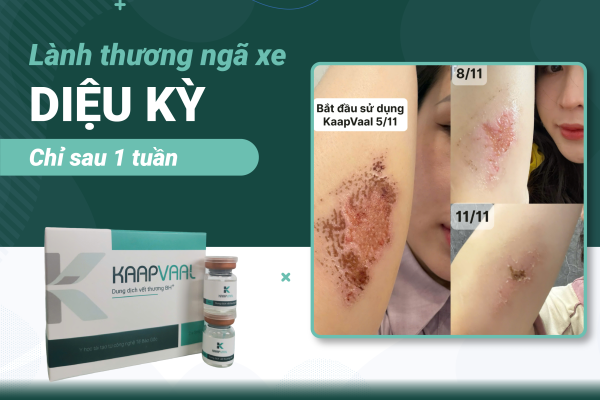 Chữa khỏi hiệu quả vết thương ngã xe chỉ sau 6 ngày