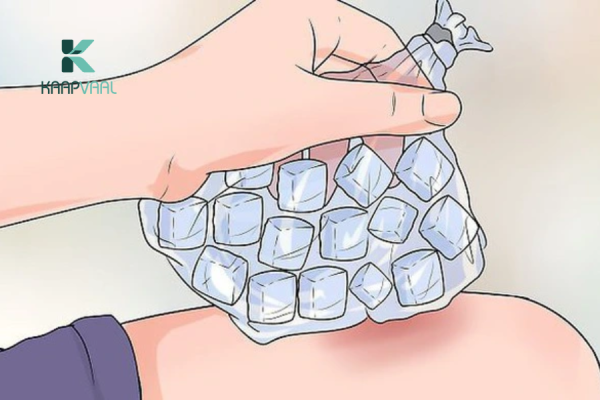 Bị Bỏng Có Nên Chườm Đá?