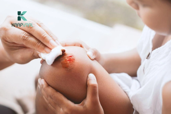 Cách Chăm Sóc Vết Thương Hở