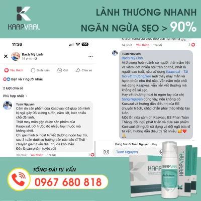 kaapvaal chữa trị loét tiểu đường