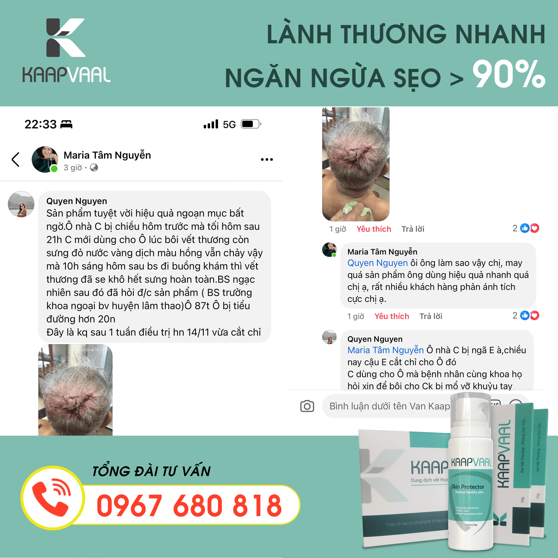 kaapvaal chữa trị vết thương hở