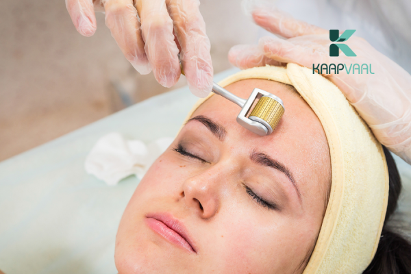 phương pháp điều trị sẹo rỗ