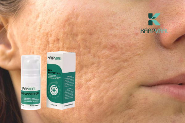 thuốc trị sẹo rỗ, sẹo lõm