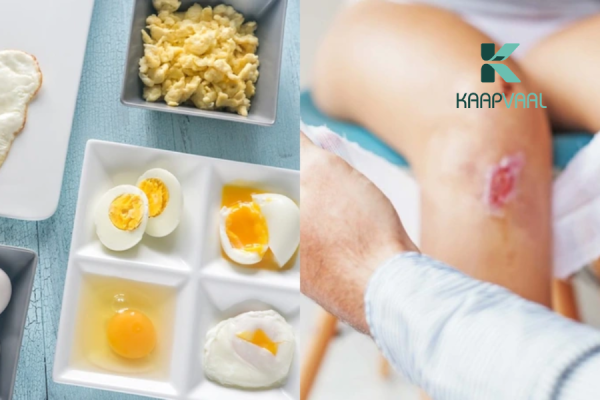 Vết thương hở không nên ăn gì