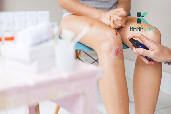 Vết thương có dịch vàng có nguy hiểm không?