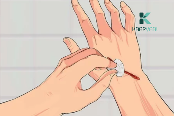 chăm sóc vết thương tại nhà