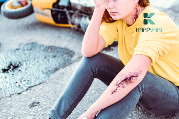 vết thương ngã xe