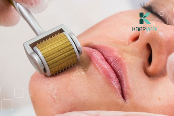 Lăn kim trị sẹo