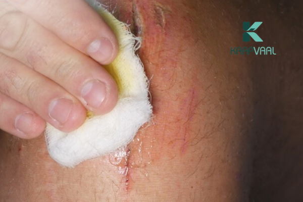 Nhiễm trùng vết mổ