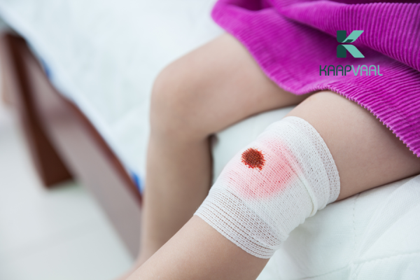 vết khâu bị rỉ máu