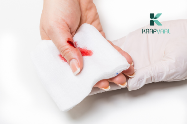 Hướng dẫn chi tiết cách sơ cứu vết thương chảy máu ngoài da