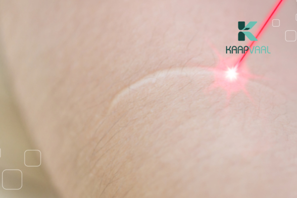 Trị sẹo lồi bằng laser