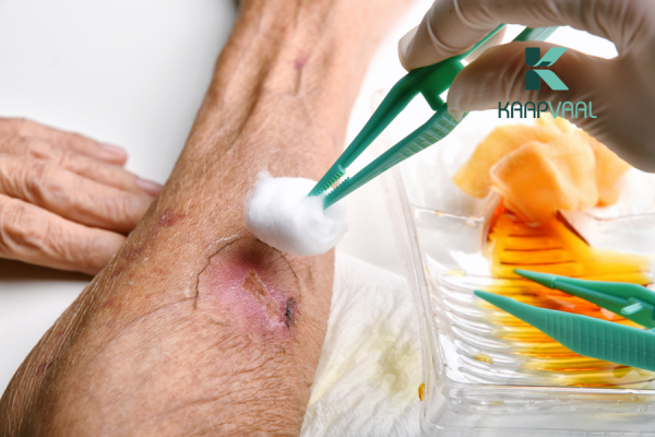 Hướng dẫn cách rửa vết thương người bị tiểu đường đúng cách và an toàn