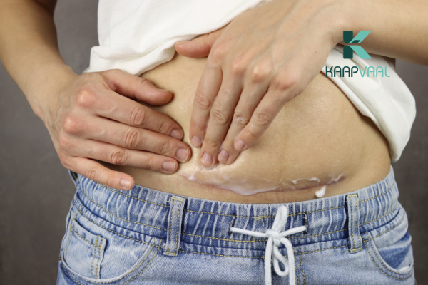 Thuốc chống sẹo