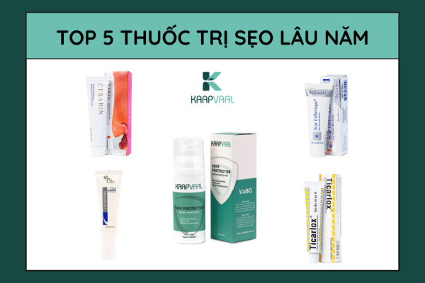 Ban sao cua TOP 5 16 2