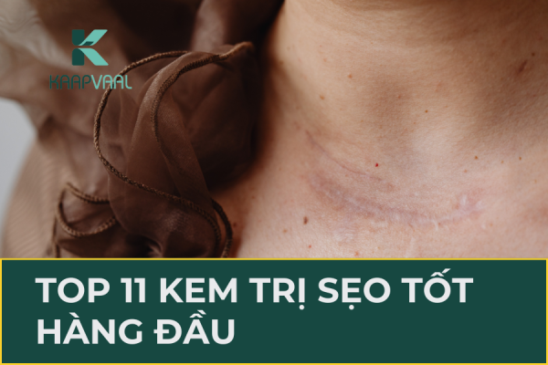Kem trị sẹo tốt