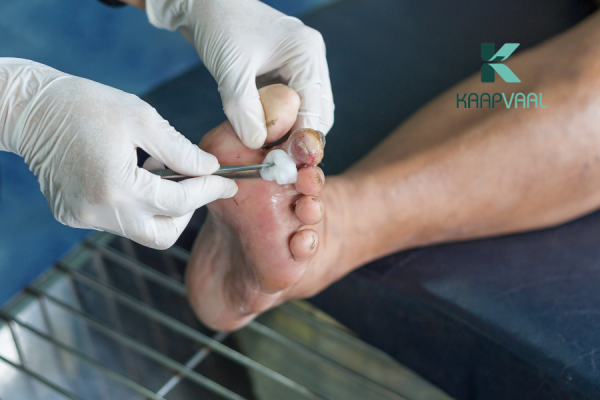 chăm sóc vết thương của người bị tiểu đường