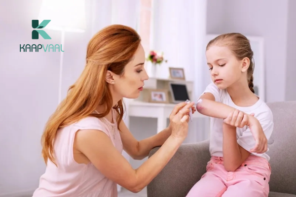 thuốc trị sẹo cho bé