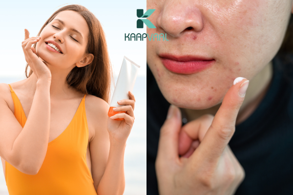 Nên bôi kem trị sẹo trước hay sau kem chống nắng?