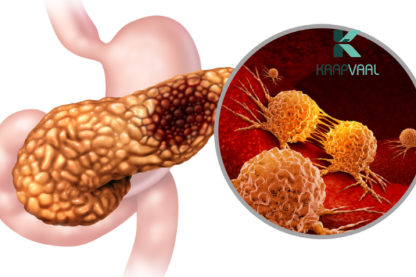 tiểu đường do bệnh lý tuyến tụy